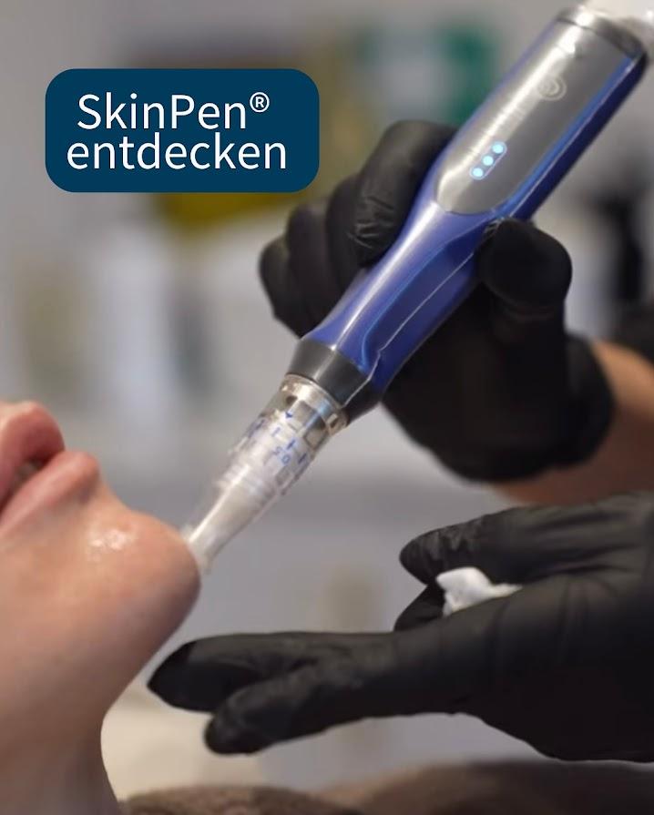 micro needling